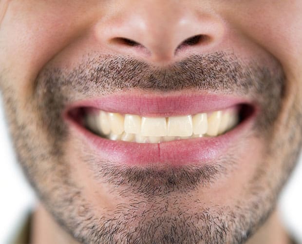 Stained Teeth Treatment